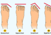 ನಿಮ್ಮ ಕಾಲ್ಬೆರಳಿನ ಆಕಾರ ಏನು ಹೇಳುತ್ತದೆ ಗೊತ್ತಾ….?
